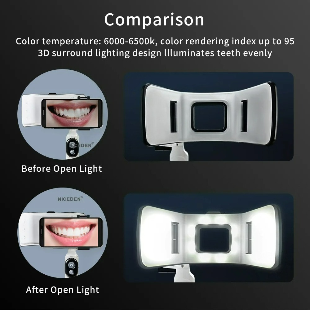 Dental Photography Light Phone - Phone Accessories For Photography ulasan dan harga