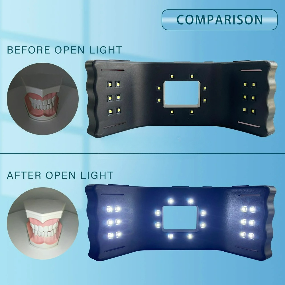 Dental Photography Light Phone - Phone Accessories For Photography ulasan dan harga